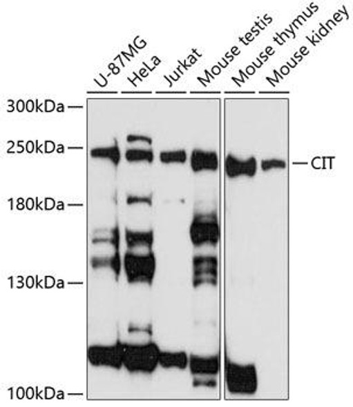 Anti-CIT Antibody (CAB3668)