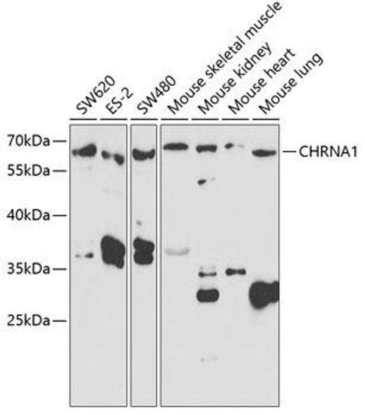 Anti-CHRNA1 Antibody (CAB5306)