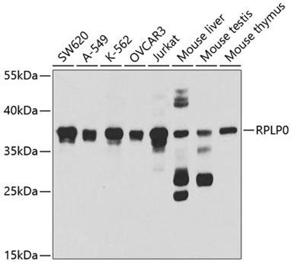 Anti-RPLP0 Antibody (CAB5557)