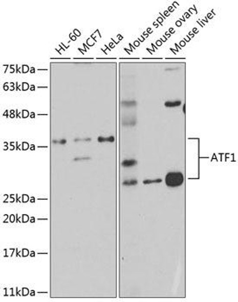 Anti-ATF1 Antibody (CAB5791)