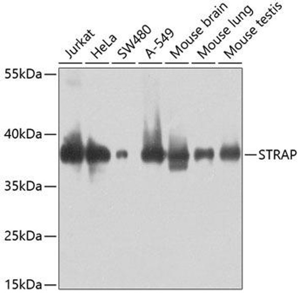 Anti-STRAP Antibody (CAB5964)