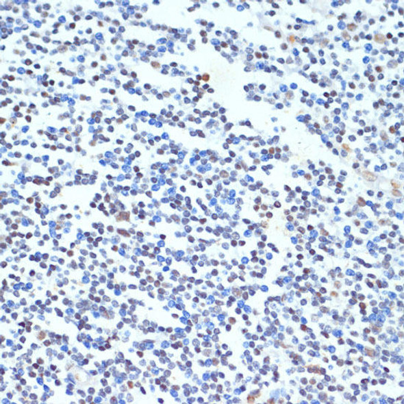 Anti-PTBP1 Antibody (CAB6107)