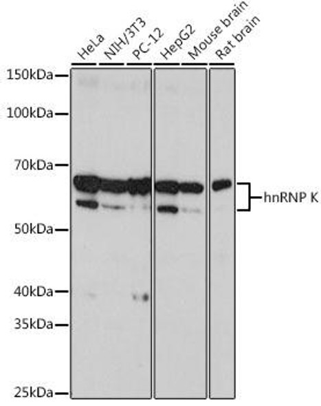 Anti-hnRNP K Antibody (CAB0772)