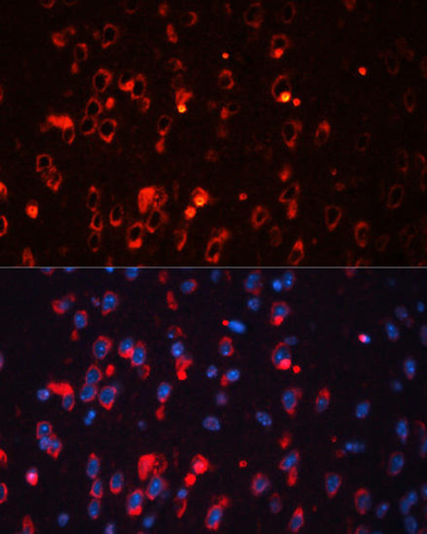 Anti-KCNA1 Antibody (CAB16906)