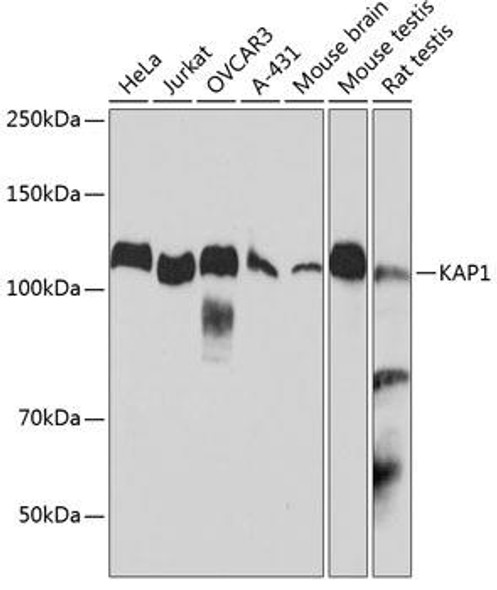 Anti-KAP1 Antibody (CAB19568)