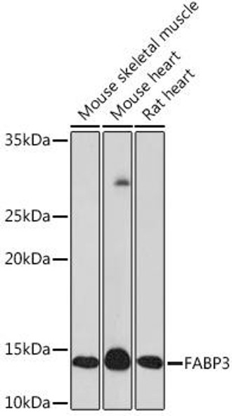 Anti-FABP3 Antibody (CAB8789)
