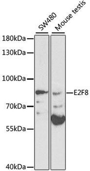 Anti-E2F8 Antibody (CAB1135)