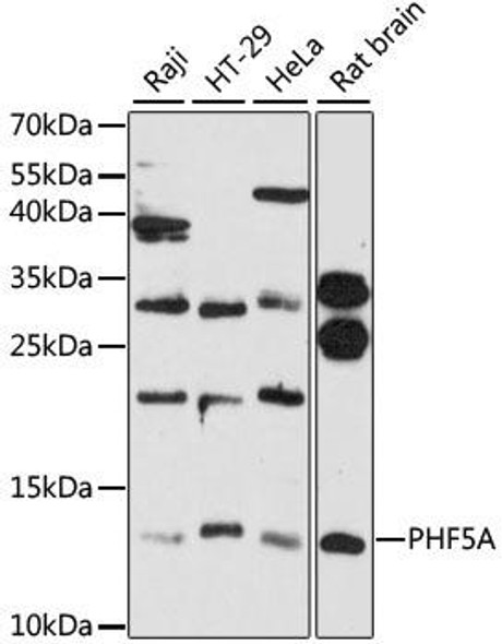 Anti-PHF5A Antibody (CAB12678)
