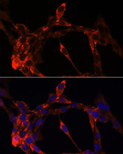 Anti-JAG1 Antibody (CAB12733)