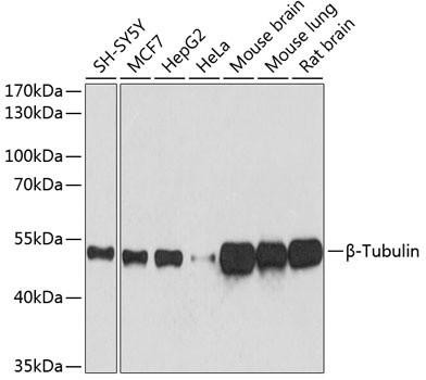 Western blot analysis of various lysates using β-Tubulin Mouse mAb (CABC021) at 1:5000 dilution. Secondary antibody: HRP-conjugated Goat anti-Mouse IgG (H+L) (CABS003) at 1:10000 dilution. Lysates/proteins: 25μg per lane. Blocking buffer: 3% nonfat dry milk in TBST. Detection: ECL Basic Kit (AbGn00020). Exposure time: 10s.