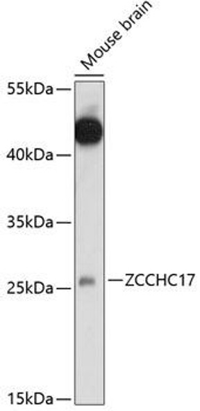 Anti-ZCCHC17 Antibody (CAB14891)