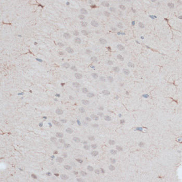 Anti-ZNF415 Antibody (CAB14913)