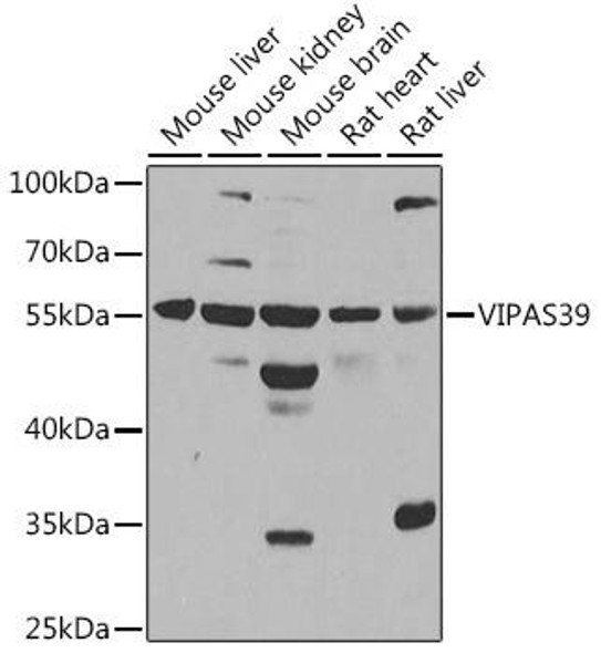 Anti-VIPAS39 Antibody (CAB14918)
