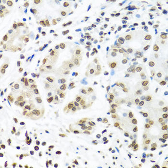 Anti-IGF2BP1 Antibody (CAB1517)