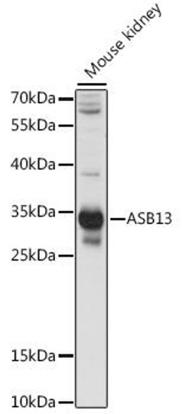 Anti-ASB13 Antibody (CAB15897)
