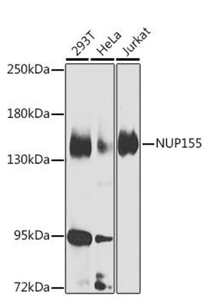 Anti-NUP155 Antibody (CAB7764)