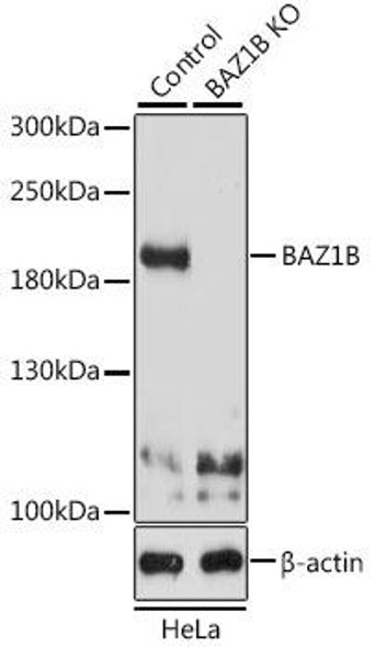 Anti-BAZ1B Antibody (CAB9851)[KO Validated]