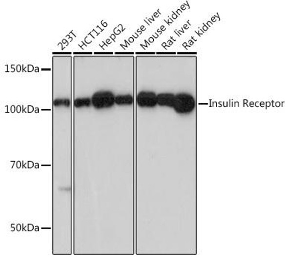 Anti-Insulin Receptor Antibody (CAB19067)