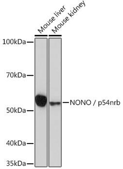 Anti-NONO / p54nrb Antibody (CAB3800)