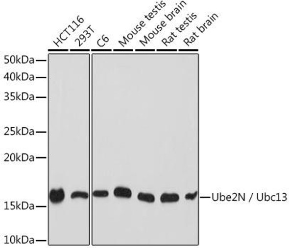 Anti-Ube2N / Ubc13 Antibody (CAB9257)