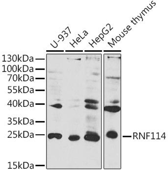 Anti-RNF114 Antibody (CAB10636)