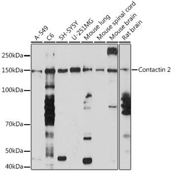 Anti-Contactin 2 Antibody (CAB5137)