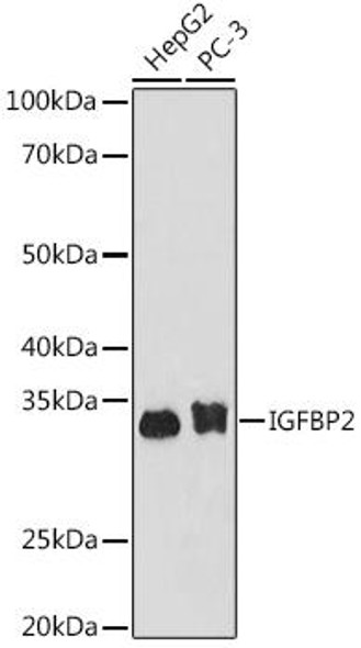 Anti-IGFBP2 Antibody (CAB9018)