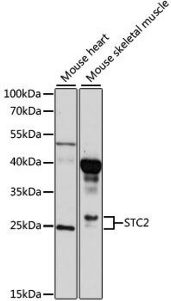 Anti-STC2 Antibody (CAB10397)