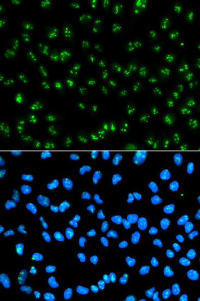 Anti-FBL Antibody (CAB1136)