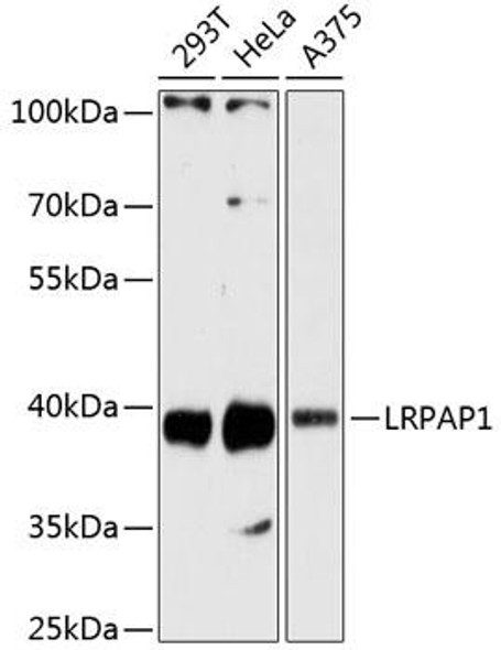 Anti-LRPAP1 Antibody (CAB13026)