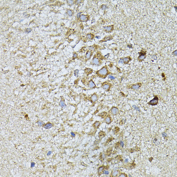 Anti-MTNR1A Antibody (CAB13030)