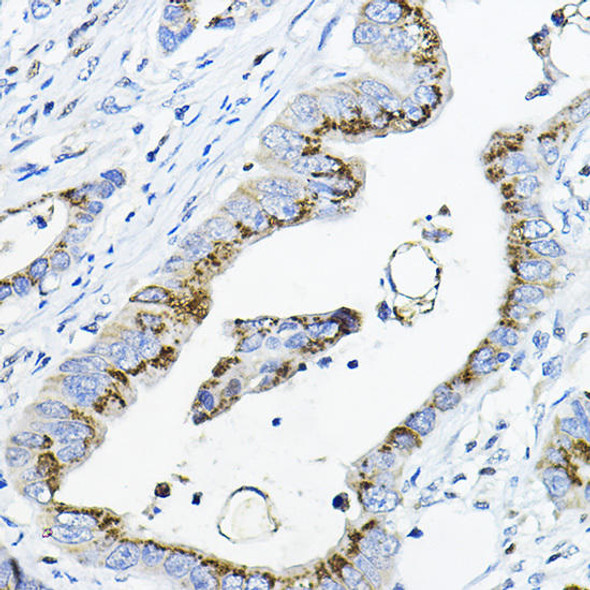 Anti-GALNT3 Antibody (CAB13985)