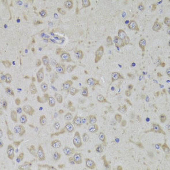 Anti-RPL3 Antibody (CAB14059)