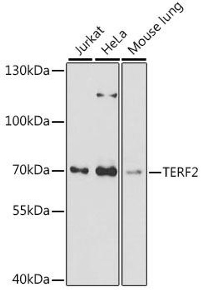 Anti-TERF2 Antibody (CAB16316)