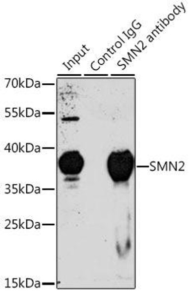 Anti-SMN2 Antibody (CAB1652)