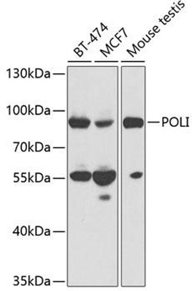 Anti-POLI Antibody (CAB1942)