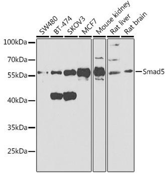 Anti-Smad5 Antibody (CAB1947)