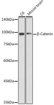 Anti-beta-Catenin Antibody -Knockout Validated (CAB11512)