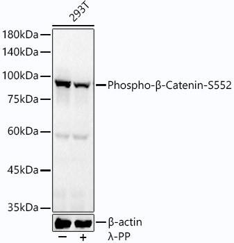 Anti-Phospho-beta-Catenin-S552 [ARC54001] Monoclonal Antibody (CABP1315)