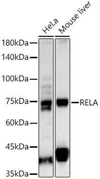 Anti-RELA Polyclonal Antibody (CAB22676)