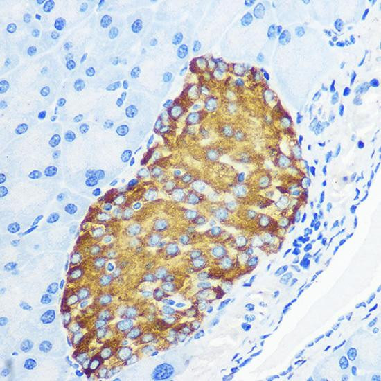 Anti-Synaptophysin Antibody (CAB6344)