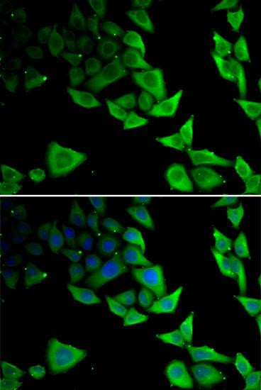 Anti-alpha-Synuclein Antibody (CAB7215)