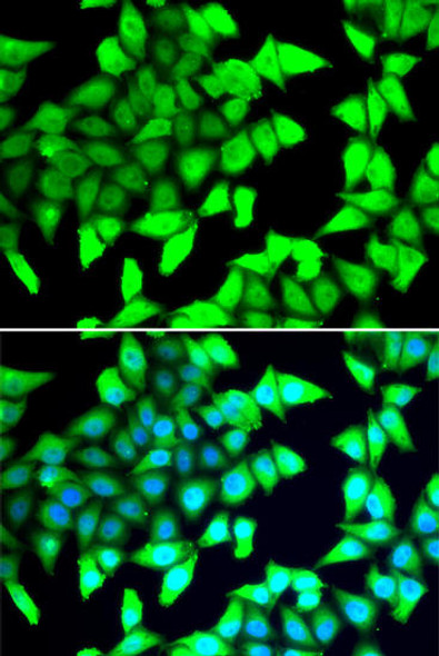 Anti-HDAC5 Antibody (CAB7189)