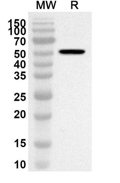 Anti-Bevacizumab Polyclonal Antibody