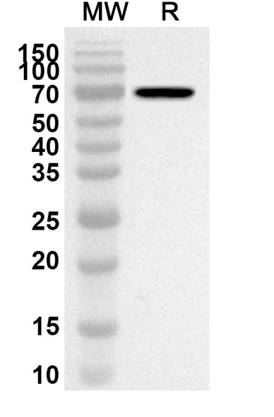Anti-Palivizumab Polyclonal Antibody
