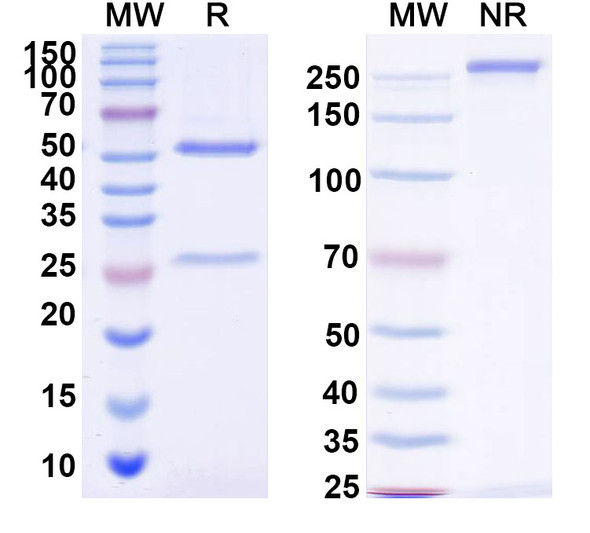 Anti-Siltuximab Neutralizing Antibody [1A455]