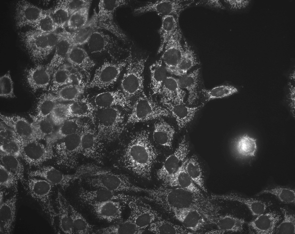 Immunocytochemistry/Immunofluorescence analysis using Mouse Anti-Hsp60 Monoclonal Antibody, Clone LK-1 (STMA00007). Tissue: HaCaT cells. Species: Human. Fixation: Cold 100% methanol at -20°C for 10 minutes. Primary Antibody: Mouse Anti-Hsp60 Monoclonal Antibody (STMA00007) at 1:100 for 1 hour at RT. Secondary Antibody: FITC Goat Anti-Mouse (green) at 1:50 for 1 hour at RT. Localization: Cytoplasmic Staining.