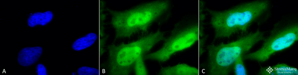 Immunocytochemistry/Immunofluorescence analysis using Rat Anti-HSF1 Monoclonal Antibody, Clone 10H8 (STMA00012). Tissue: Heat Shocked cervical cancer cells (HeLa). Species: Human. Fixation: 2% Formaldehyde for 20 min at RT. Primary Antibody: Rat Anti-HSF1 Monoclonal Antibody (STMA00012) at 1:100 for 12 hours at 4°C. Secondary Antibody: FITC Goat Anti-Rat (green) at 1:200 for 2 hours at RT.