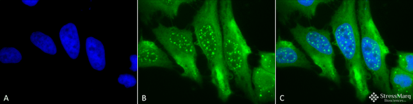 Immunocytochemistry/Immunofluorescence analysis using Mouse Anti-HO-1 Monoclonal Antibody, Clone 1F12-A6 (STMA00018). Tissue: Cervical cancer cell line (HeLa). Species: Human. Fixation: 2% Formaldehyde for 20 min at RT. Primary Antibody: Mouse Anti-HO-1 Monoclonal Antibody (STMA00018) at 1:100 for 12 hours at 4°C. Secondary Antibody: FITC Goat Anti-Mouse (green) at 1:200 for 2 hours at RT.
