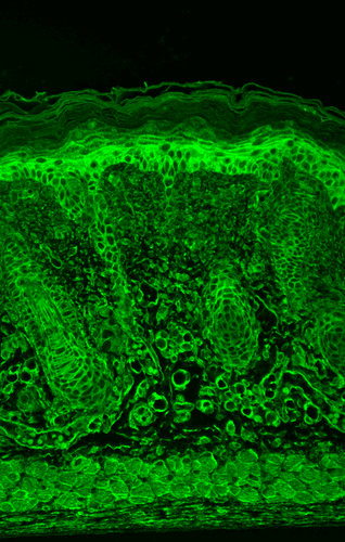 Immunohistochemistry analysis using Mouse Anti-HIF1 alpha Monoclonal Antibody, Clone ESEE122 (STMA00049). Tissue: backskin. Species: Mouse. Fixation: Bouin's Fixative and paraffin-embedded. Primary Antibody: Mouse Anti-HIF1 alpha Monoclonal Antibody (STMA00049) at 1:100 for 1 hour at RT. Secondary Antibody: FITC Goat Anti-Mouse (green) at 1:50 for 1 hour at RT.